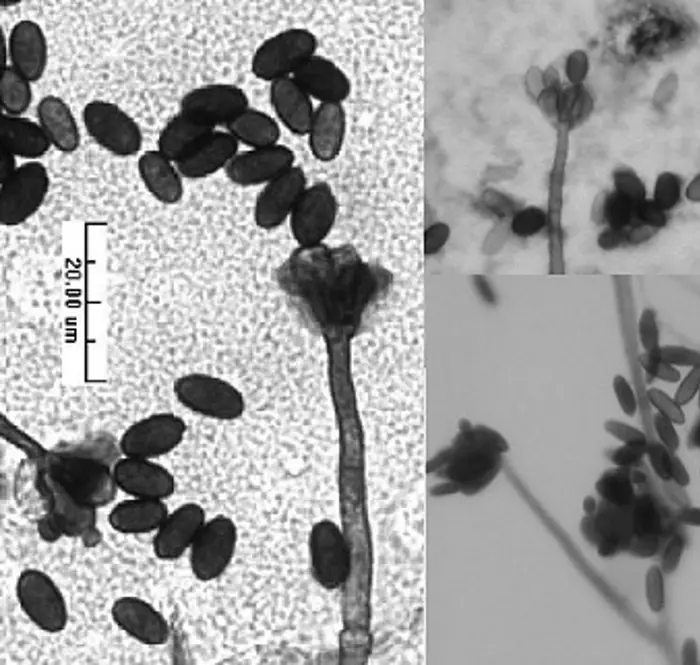 Microscopic black and white image showing mold spores and sporangia, essential in our investigation. The spores appear as small, oval shapes clustered around thin stalks. A scale bar indicates a length of 20.0 µm.
